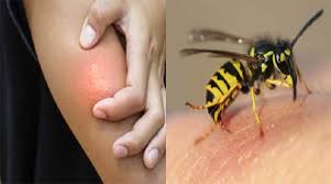 குளவிக் கொட்டுக்கு இலக்கான பல்கலைக்கழக மாணவர்கள் வைத்தியசாலையில் அனுமதி குளவிக் கொட்டுக்கு இலக்கான பல்கலைக்கழக மாணவர்கள் வைத்தியசாலையில் அனுமதி